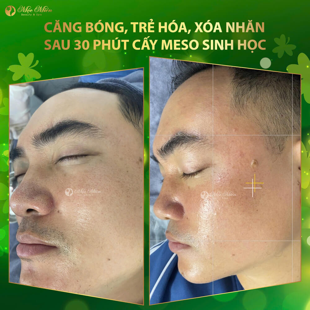 Feedback khách hàng